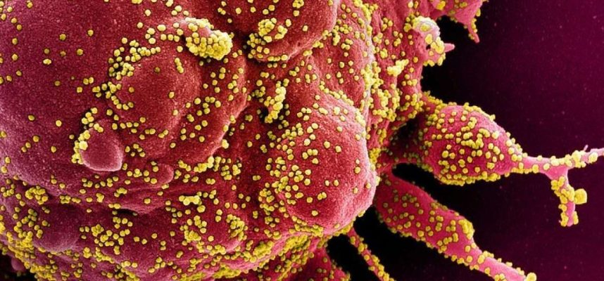 Estudo mostra que o COVID-19 pode forçar sistemas imunológicos a atacar 