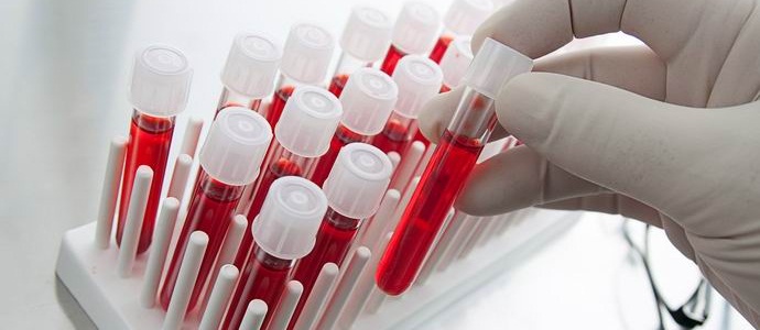 Os canadenses podem tornar todos os tipos de sangue compatíveis