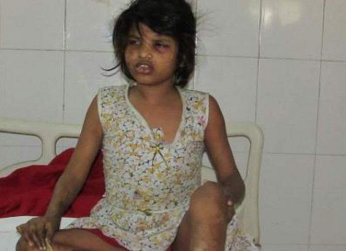 Encontrada garota Mowgli de 8 anos criada por macacos