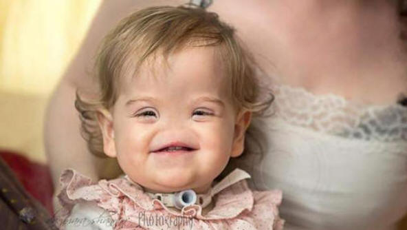 Uma doença rara: uma menina sem nariz nasceu na Grã-Bretanha