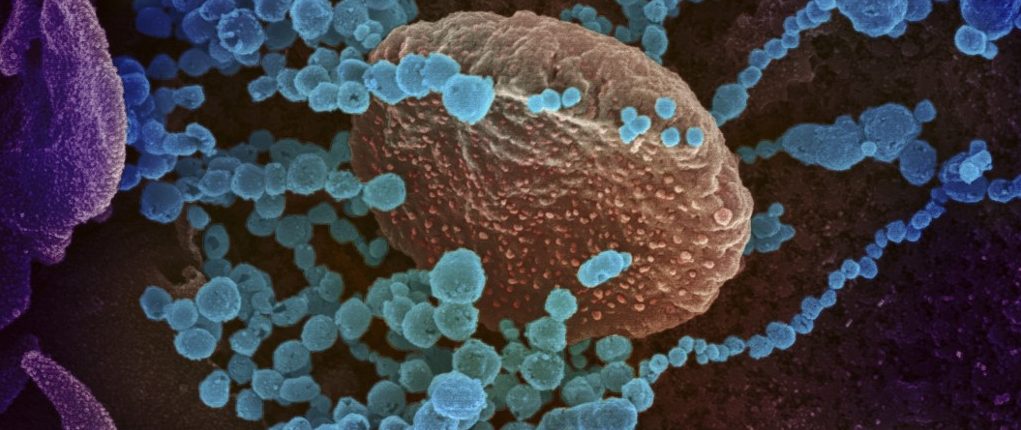 Os cientistas viram como nosso sistema imunológico combate o coronavírus 