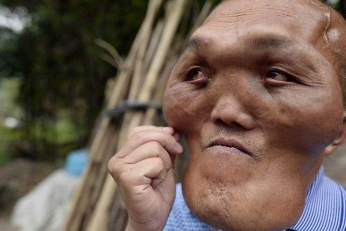 Um homem com uma cabeça alienígena encontrada na China